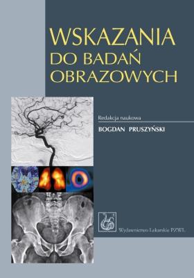 Wskazania do badań obrazowych. Autor: Robert Chrzan, Laretta Grabowska-Derlatka. SmakLiter.pl Okładka książki Wskazania do badań obrazowych