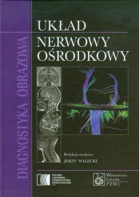 Diagnostyka obrazowa Układ nerwowy ośrodkowy PZWL. Autor:   Praca zbiorowa. SmakLiter.pl Okładka książki Diagnostyka obrazowa Układ nerwowy ośrodkowy PZWL