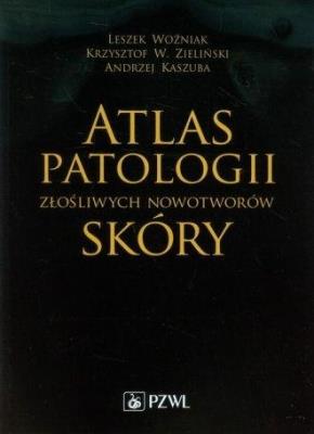 Okładka książki Atlas patologii złośliwych nowotworów skóry