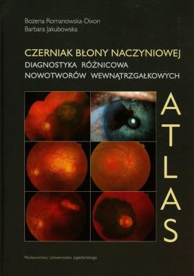 Czerniak błony naczyniowej. Diagnostyka różnicowa. Autor: Romanowska-Dixon Bożena, Jakubowska Barbara. SmakLiter.pl Okładka książki Czerniak błony naczyniowej. Diagnostyka różnicowa