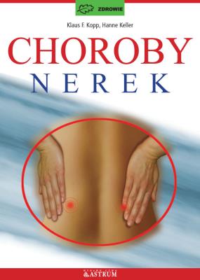 Choroby nerek. Autor: Kopp Klaus F., Kopp F. Kopp. Keller Hanne. SmakLiter.pl Okładka książki Choroby nerek