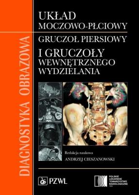 Diagnostyka obrazowa Układ moczowo-płciowy, gruczoł piersiowy i gruczoły wewnętrznego wydzielania. Autor: Opracowanie zbiorowe. SmakLiter.pl Okładka książki Diagnostyka obrazowa Układ moczowo-płciowy, gruczoł piersiowy i gruczoły wewnętrznego wydzielania