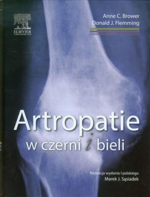Artropatie w czerni i bieli. Autor: Brower Anne C., Flemming Donald J.. SmakLiter.pl Okładka książki Artropatie w czerni i bieli