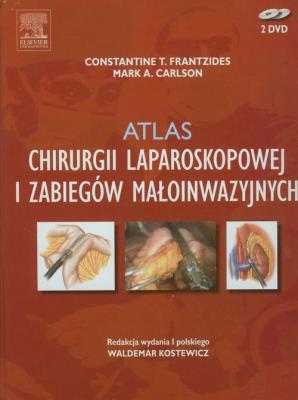 Atlas chirurgii laparoskopowej i zabiegów małoinwazyjnych. Autor: Frantzides Constantine T., Carlson Mark A.. SmakLiter.pl Okładka książki Atlas chirurgii laparoskopowej i zabiegów małoinwazyjnych