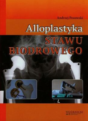 Okładka książki Alloplastyka stawu biodrowego
