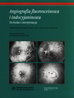 Angiografia fluoresceinowa i indocyjaninowa. Autor: Berkow Joseph W., Flower Robert W., Orth David H., Kelley James S.. SmakLiter.pl Okładka książki Angiografia fluoresceinowa i indocyjaninowa