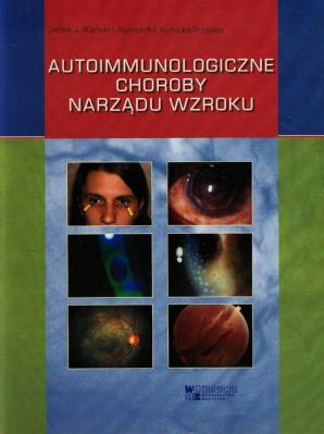 Autoimmunologiczne choroby narządu wzroku. Autor: Kański Jacek J., Kubicka-Trząska Agnieszka. SmakLiter.pl Okładka książki Autoimmunologiczne choroby narządu wzroku