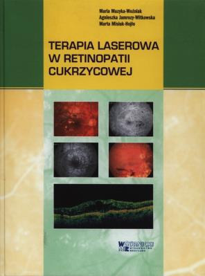 Terapia laserowa w retinopatii cukrzycowej. Autor: Muzyka-Woźniak Maria, Jamrozy-Witkowska Agnieszka, Misiuk-Hojło Marta. SmakLiter.pl Okładka książki Terapia laserowa w retinopatii cukrzycowej