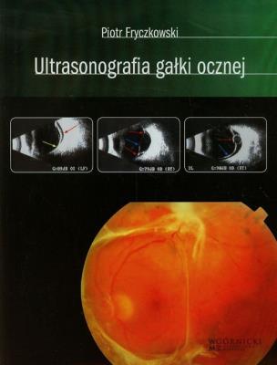 Ultrasonografia gałki ocznej. Autor: Fryczkowski Piotr. SmakLiter.pl Okładka książki Ultrasonografia gałki ocznej