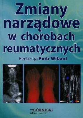 Zmiany narządowe w chorobach reumatycznych. Autor: Wiland Piotr. SmakLiter.pl Okładka książki Zmiany narządowe w chorobach reumatycznych