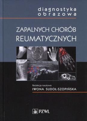 Diagnostyka obrazowa zapalnych chorób reumatycznych. Autor: Sudoł-Szopińska  Iwona. SmakLiter.pl Okładka książki Diagnostyka obrazowa zapalnych chorób reumatycznych