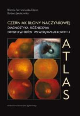 Czerniak błony naczyniowej Atlas. Autor: Romanowska-Dixon Bożena, Jakubowska Barbara. SmakLiter.pl Okładka książki Czerniak błony naczyniowej Atlas