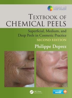 Okładka książki Textbook of Chemical Peels