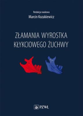 Opakowanie Złamania wyrostka kłykciowego żuchwy
