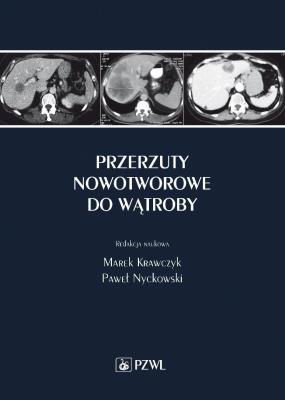 Okładka książki Przerzuty nowotworowe do wątroby