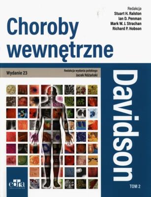 Okładka książki Davidson Choroby wewnętrzne Tom 2