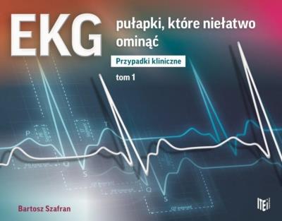 EKG pułapki, które niełatwo ominąć Przypadki kliniczne Tom 1. Autor: Szafran Bartosz. SmakLiter.pl Okładka książki EKG pułapki, które niełatwo ominąć Przypadki kliniczne Tom 1