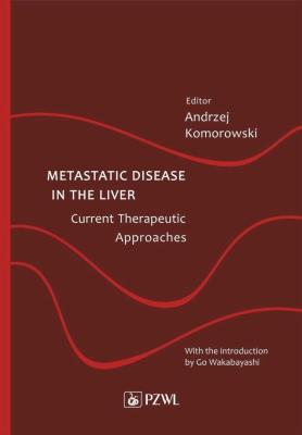 Okładka książki Metastatic Disease in the Liver - Current Therapeutic Approaches