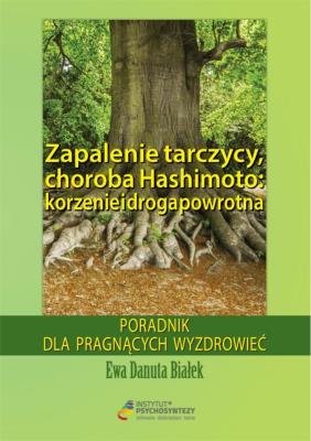 Okładka książki Zapalenie terczycy, choroba Hashimoto