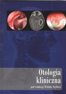 Otologia kliniczna. Autor: Witolda Szyftera. SmakLiter.pl Okładka książki Otologia kliniczna