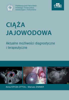 Okładka książki Ciąża jajowodowa Aktualne możliwości diagnostyczne i terapeutyczne