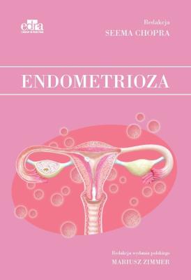 Okładka książki Endometrioza