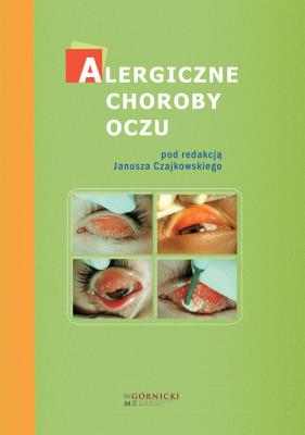 Alergiczne choroby oczu. Autor: Bogacka Ewa, Czajkowski Janusz, Małolepszy Józef. SmakLiter.pl Okładka książki Alergiczne choroby oczu