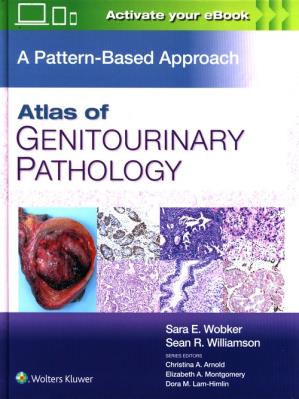 Atlas of Genitourinary Pathology. Autor: Wobker Sara E., Williamson Sean R.. SmakLiter.pl Okładka książki Atlas of Genitourinary Pathology