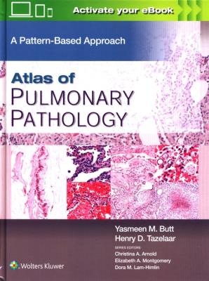 Atlas of Pulmonary Pathology. Autor: Mahmood Butt Yasmeen, Tazelaar Henry D.. SmakLiter.pl Okładka książki Atlas of Pulmonary Pathology