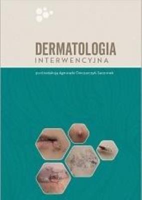 Okładka książki Dermatologia interwencyjna