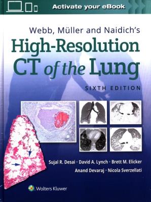 Okładka książki Webb, Müller and Naidich's High-Resolution CT of the Lung Sixth edition