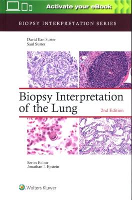 Okładka książki Biopsy Interpretation of the Lung Second edition