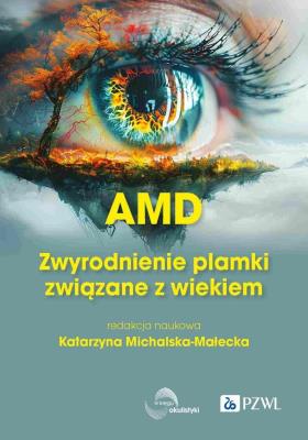 AMD Zwyrodnienie plamki żółtej związane z wiekiem. Autor: Michalska-Małecka Katarzyna. SmakLiter.pl Okładka książki AMD Zwyrodnienie plamki żółtej związane z wiekiem
