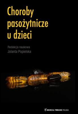 Choroby pasożytnicze u dzieci. Autor: Jolanta Popielska. SmakLiter.pl Okładka książki Choroby pasożytnicze u dzieci