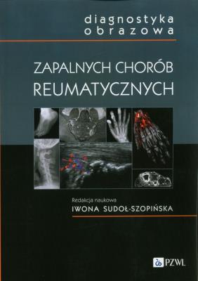 Diagnostyka obrazowa zapalnych chorób reumatycznych. Autor:   Praca zbiorowa. SmakLiter.pl Okładka książki Diagnostyka obrazowa zapalnych chorób reumatycznych