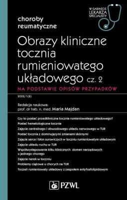 Okładka książki Obrazy kliniczne tocznia rumieniowatego układowego Część 2 Na podstawie opisów przypadków