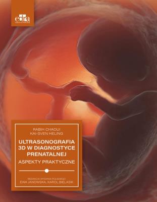 Ultrasonografia 3D w diagnostyce prenatalnej. Autor: R. Chaoui. SmakLiter.pl Okładka książki Ultrasonografia 3D w diagnostyce prenatalnej