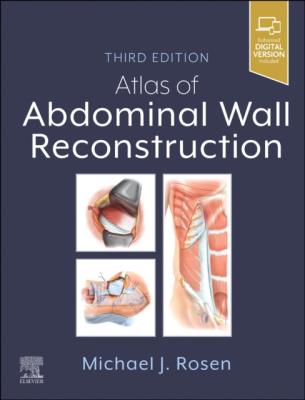 Okładka książki Atlas of Abdominal Wall Reconstruction