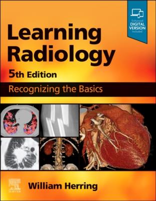 Okładka książki Learning Radiology