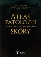 Atlas patologii złośliwych nowotworów skóry. Autor: Woźniak Leszek, Zieliński Krzysztof W., Kaszuba Andrzej. SmakLiter.pl Okładka książki Atlas patologii złośliwych nowotworów skóry