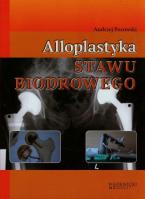 Alloplastyka stawu biodrowego. Autor: Pozowski Andrzej. SmakLiter.pl Okładka książki Alloplastyka stawu biodrowego