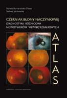 Czerniak błony naczyniowej Atlas. Autor: Romanowska-Dixon Bożena, Jakubowska Barbara. SmakLiter.pl Okładka książki Czerniak błony naczyniowej Atlas