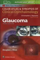 Glaucoma. Autor: Rhee Douglas. SmakLiter.pl Okładka książki Glaucoma