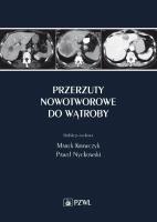 Okładka książki Przerzuty nowotworowe do wątroby