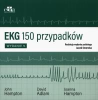 Okładka książki EKG 150 przypadków