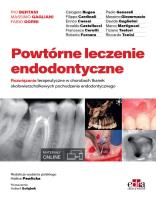 Okładka książki Powtórne leczenie endodontyczne