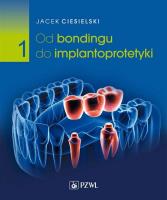 Od bondingu do implantoprotetyki Część 1. Autor: Jacek Ciesielski. SmakLiter.pl Okładka książki Od bondingu do implantoprotetyki Część 1