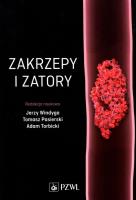 Okładka książki Zakrzepy i zatory