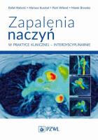 Zapalenia naczyń w praktyce klinicznej interdyscyplinarnie. Autor: Małecki Rafał, Kusztal Mariusz, Wiland Piotr, Brzosko Marek. SmakLiter.pl Okładka książki Zapalenia naczyń w praktyce klinicznej interdyscyplinarnie