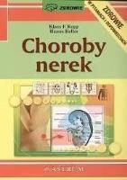 Choroby nerek. Autor: Kopp Klaus F., Hanne Keller. SmakLiter.pl Okładka książki Choroby nerek